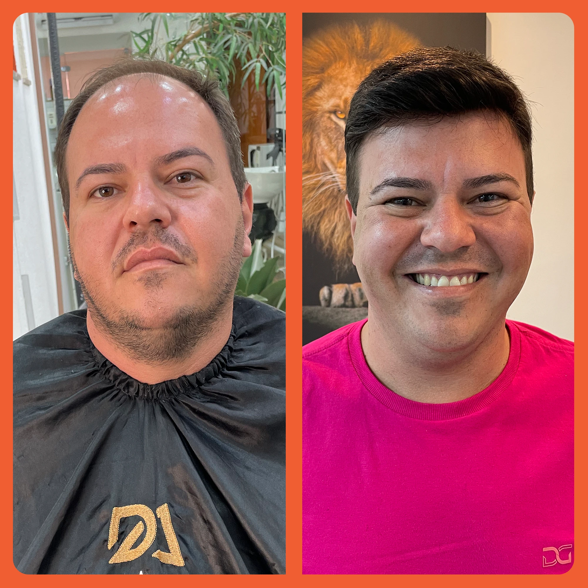 mostrar o antes e depois do uso da prótese capilar