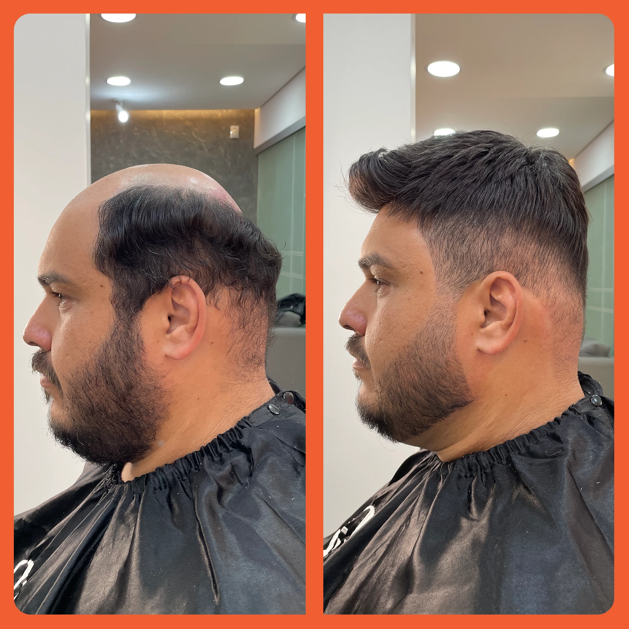 mostrar o antes e depois do uso da prótese capilar