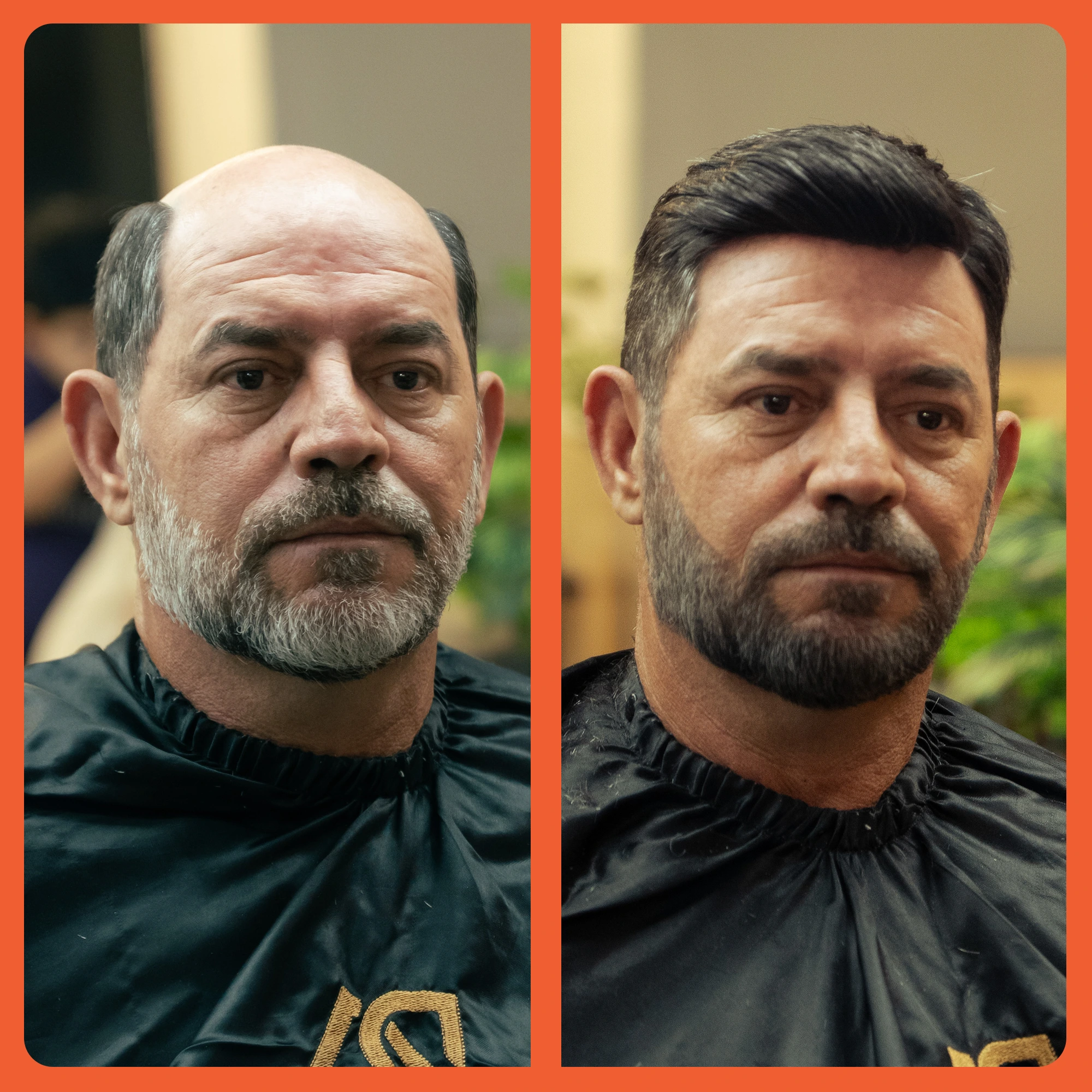 mostrar o antes e depois do uso da prótese capilar