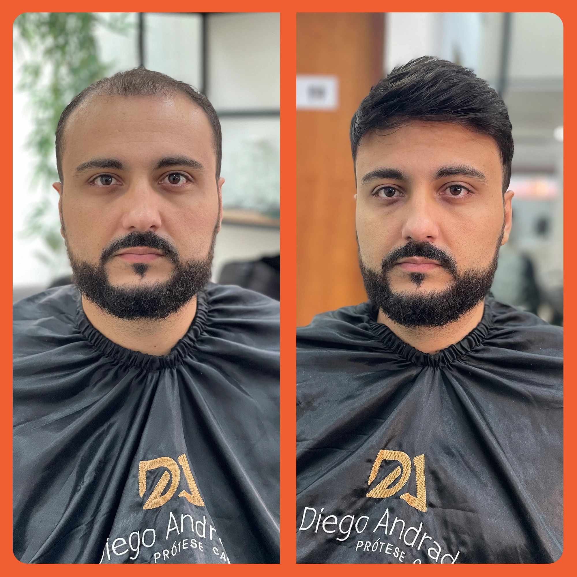 mostrar o antes e depois do uso da prótese capilar