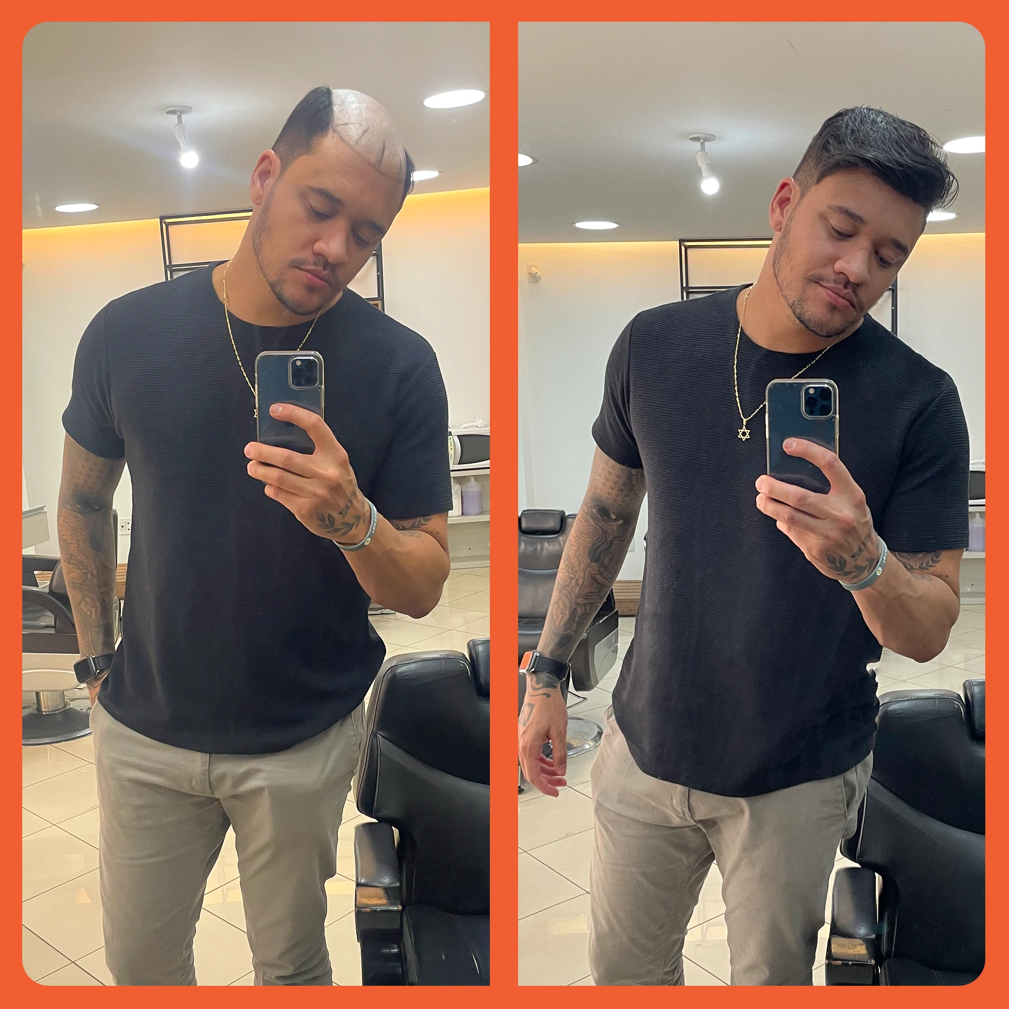 mostrar o antes e depois do uso da prótese capilar