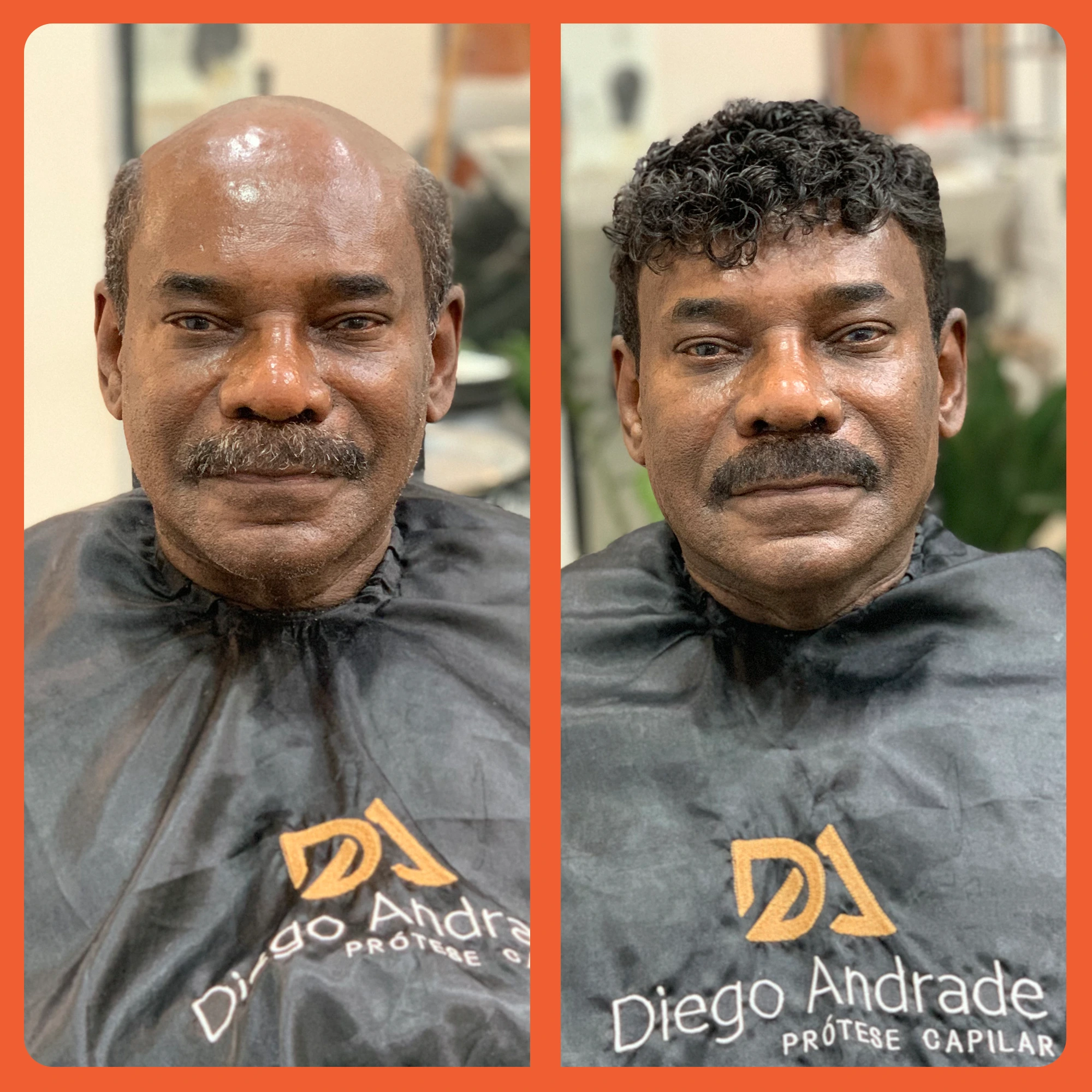 mostrar o antes e depois do uso da prótese capilar em cabelo afro
