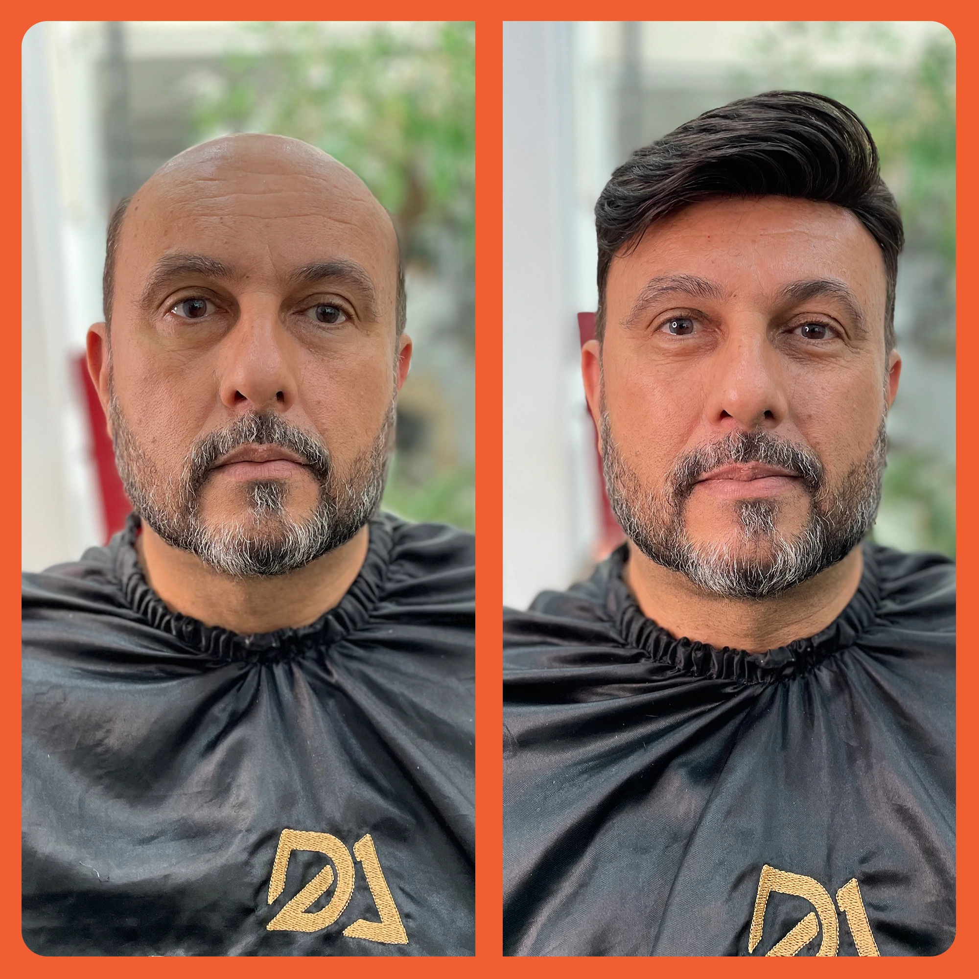 mostrar o antes e depois do uso da prótese capilar