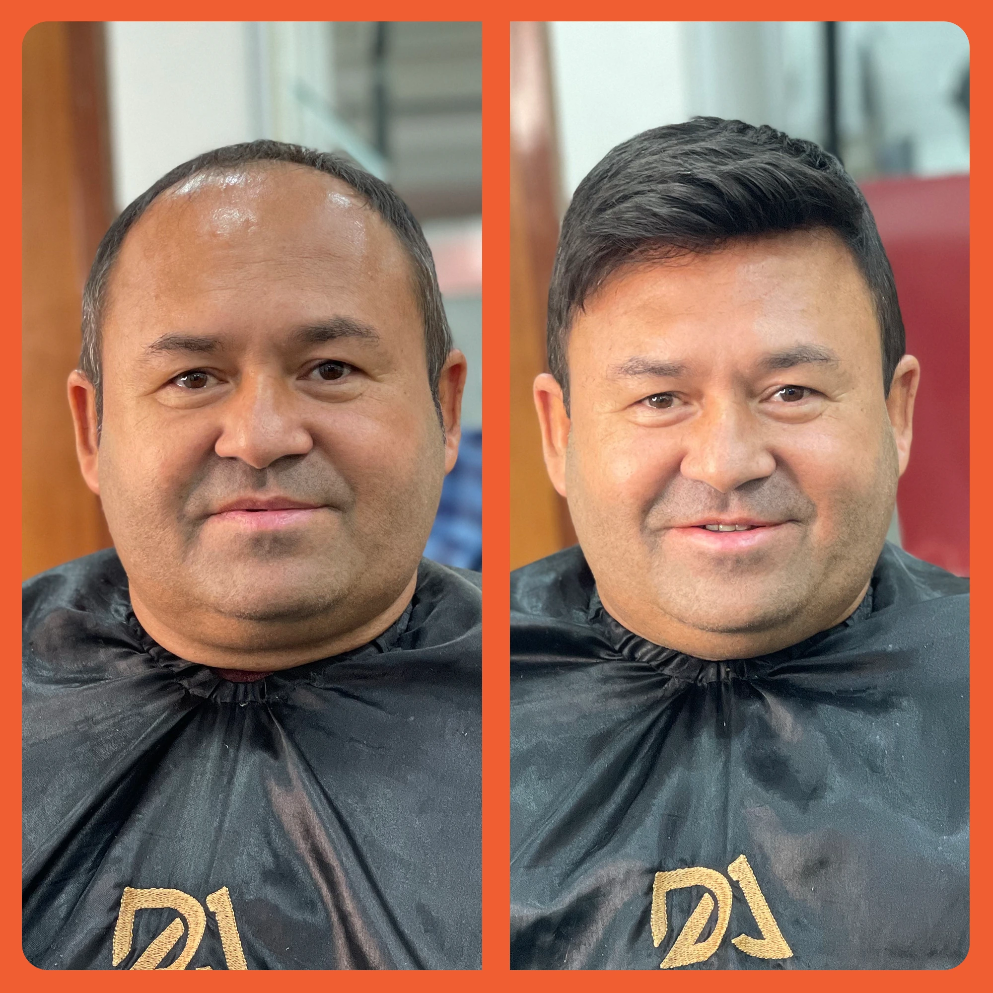 mostrar o antes e depois do uso da prótese capilar