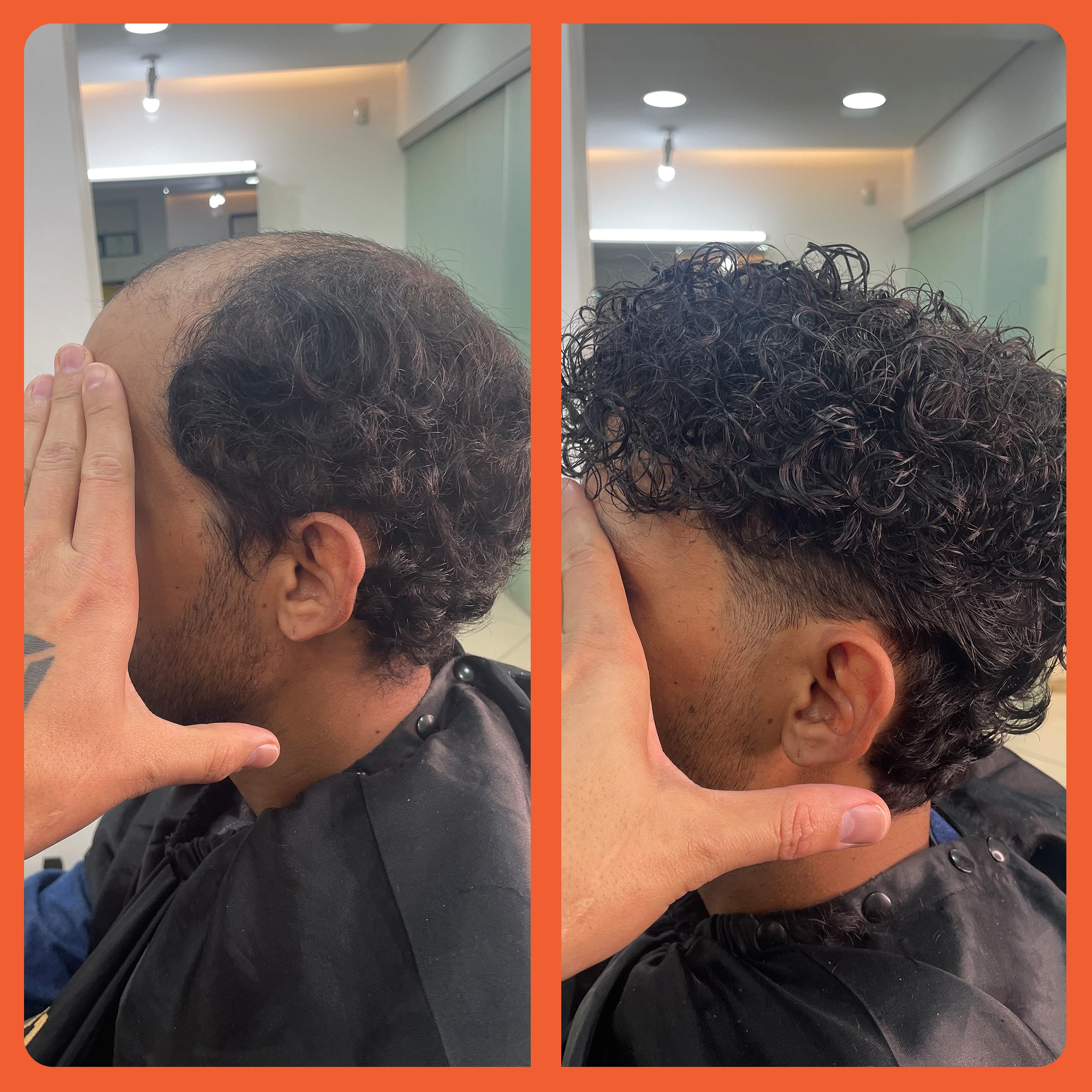 mostrar o antes e depois do uso da prótese capilar