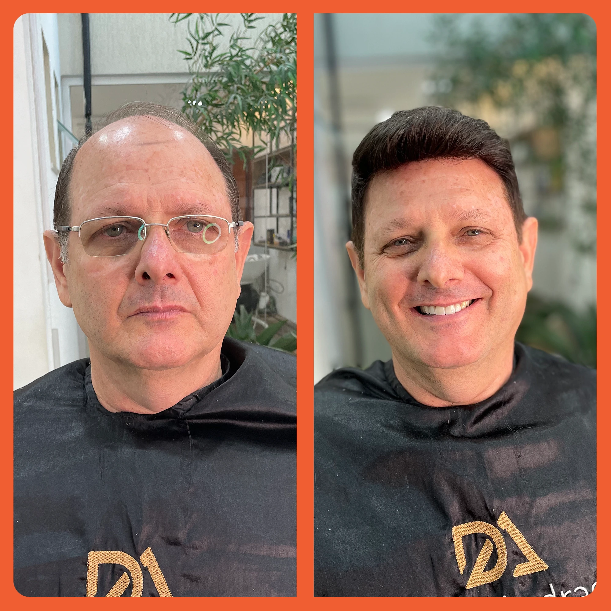 mostrar o antes e depois do uso da prótese capilar